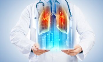 Rozpoznanie pylicy płuc wymaga wykazania obecności na zdjęciu RTG ściśle określonego typu zmian